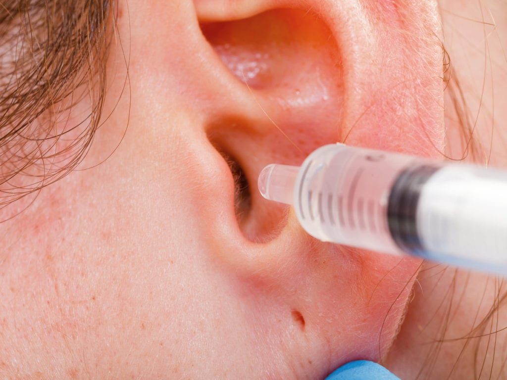 Doctor using a syringe to administer warm water to patients ear for wax removal