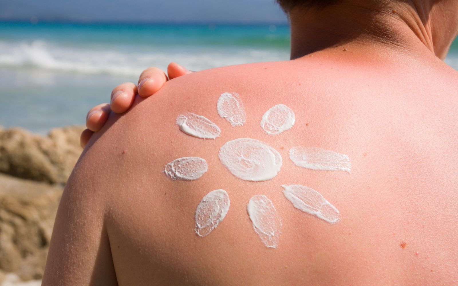 Man with sunscreen flower on shoulder